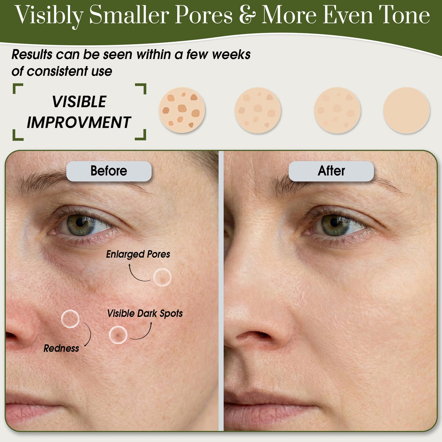 Niacinamide 10% + Zinc Serum before and after use