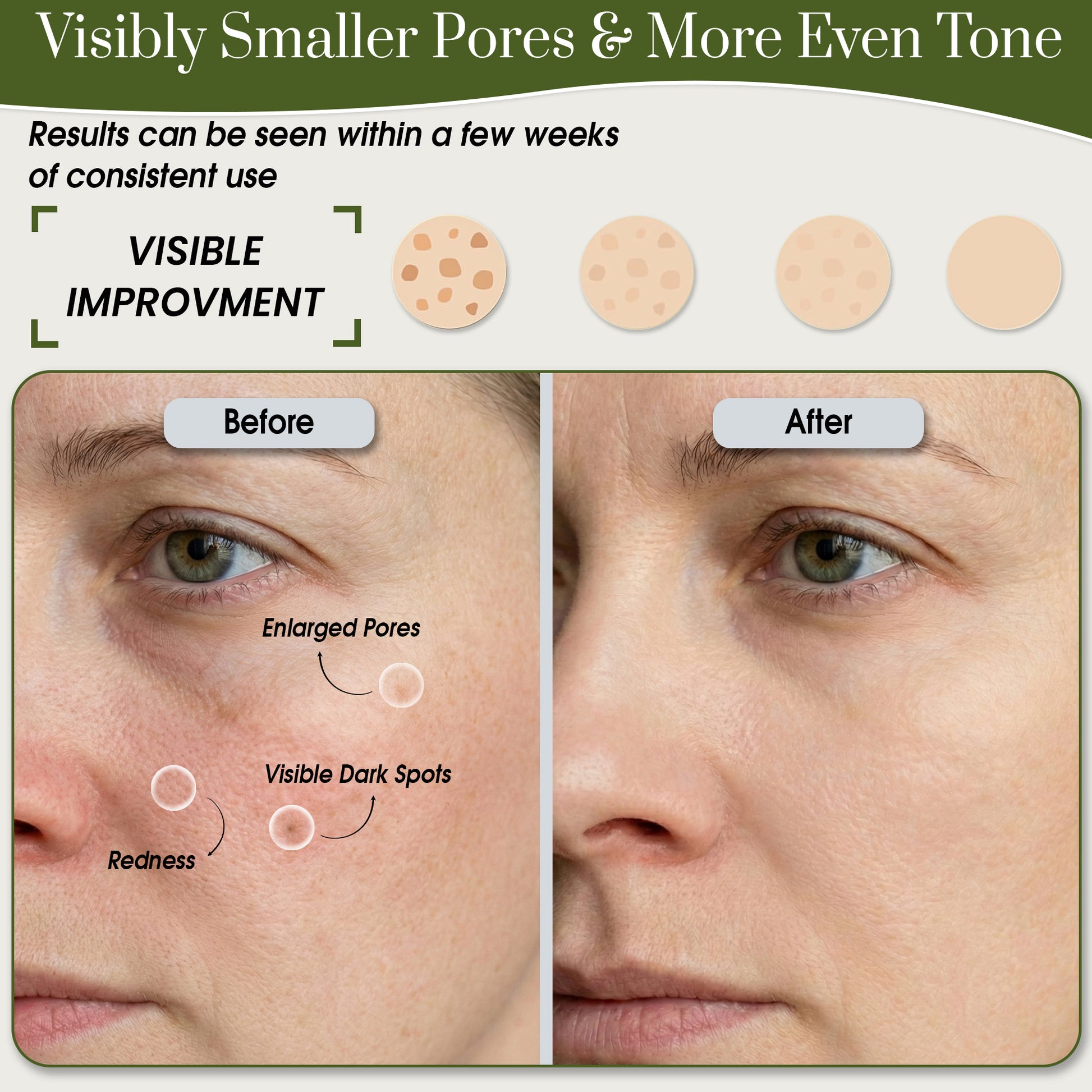 Niacinamide 10% + Zinc Serum before and after use