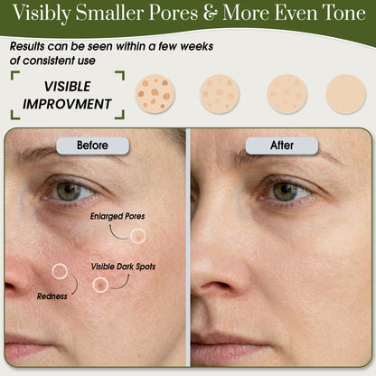 Niacinamide 10% + Zinc Serum before and after use
